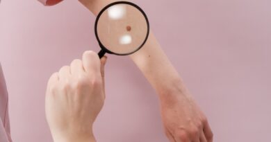 Controllo melanoma, foto da Pexels